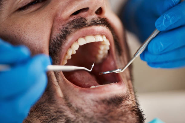 Best Chipped Tooth Repair Near Me  in Maysville, NC
